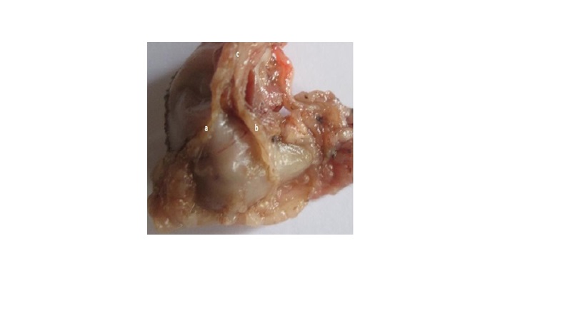 Gross examination of the stomach of rats